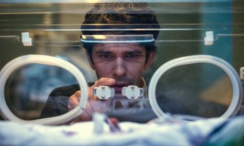 SRF zwei: This Is Going to Hurt