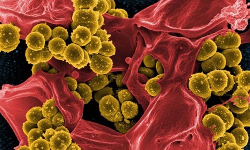 Surviving Superbugs &ndash; A Dance To Resist