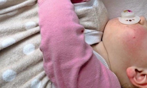 Notf&auml;lle Kinder 0 &ndash; 4